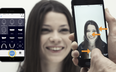 Perchè Usare Dental Shooting? L’APP specifica di fotografia dentale