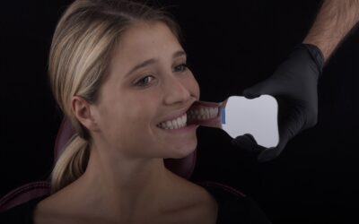 Eleva la Qualità delle Tue Immagini Odontoiatriche: I 5 Strumenti Essenziali per la Fotografia Dentale